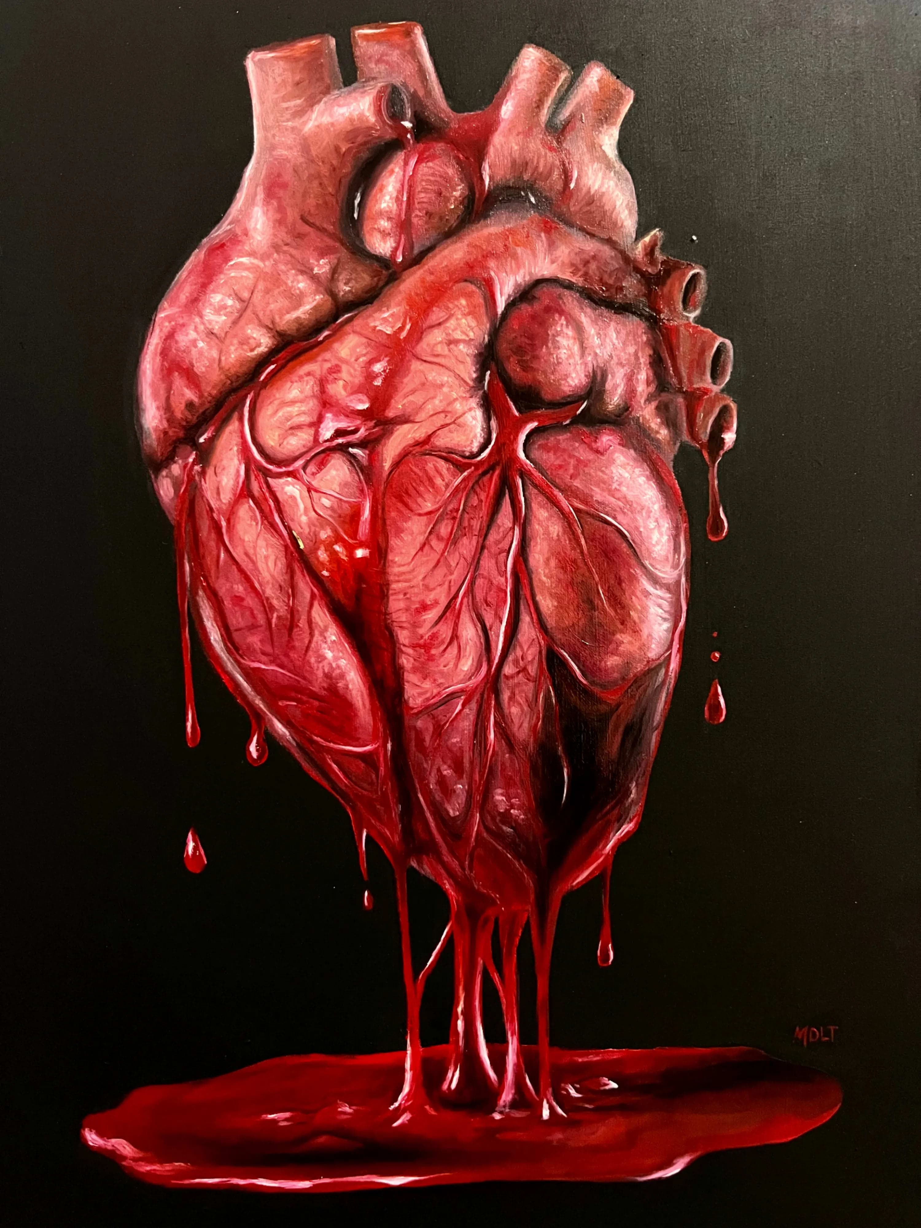Corazon abierto