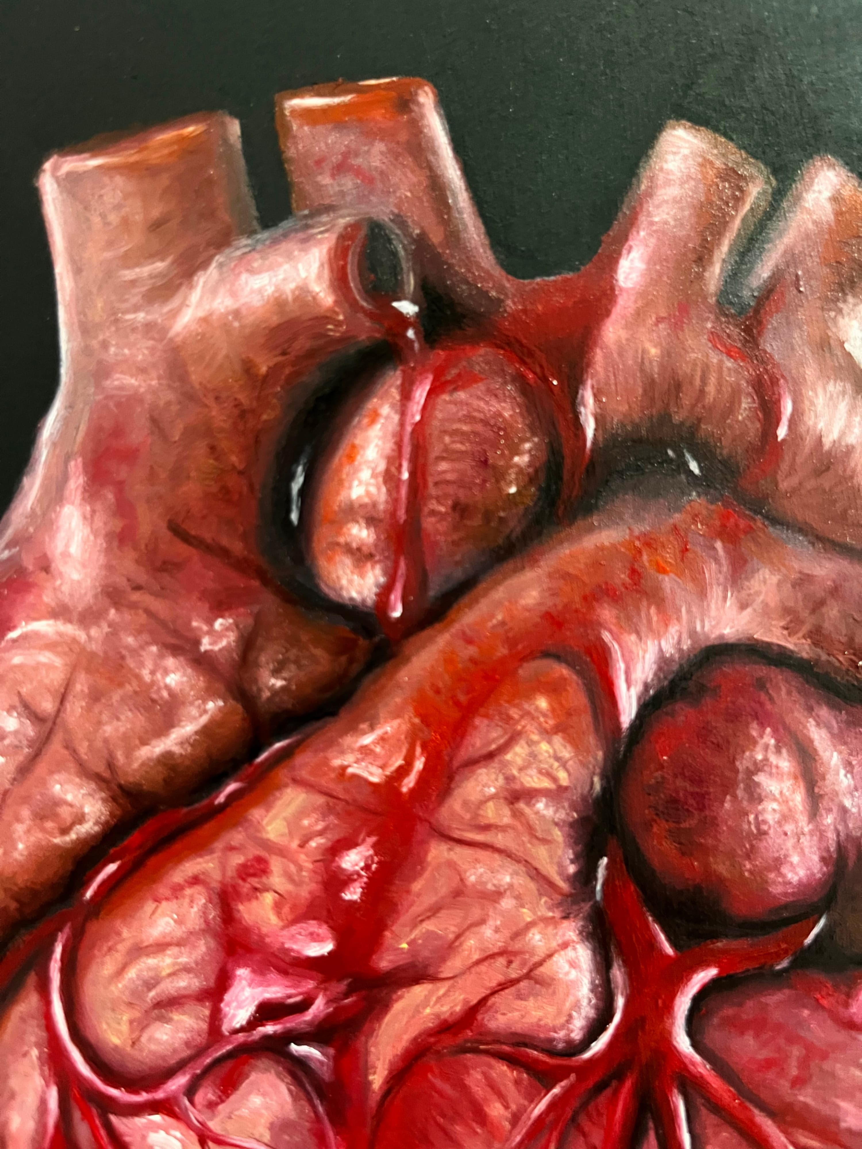 Corazon abierto