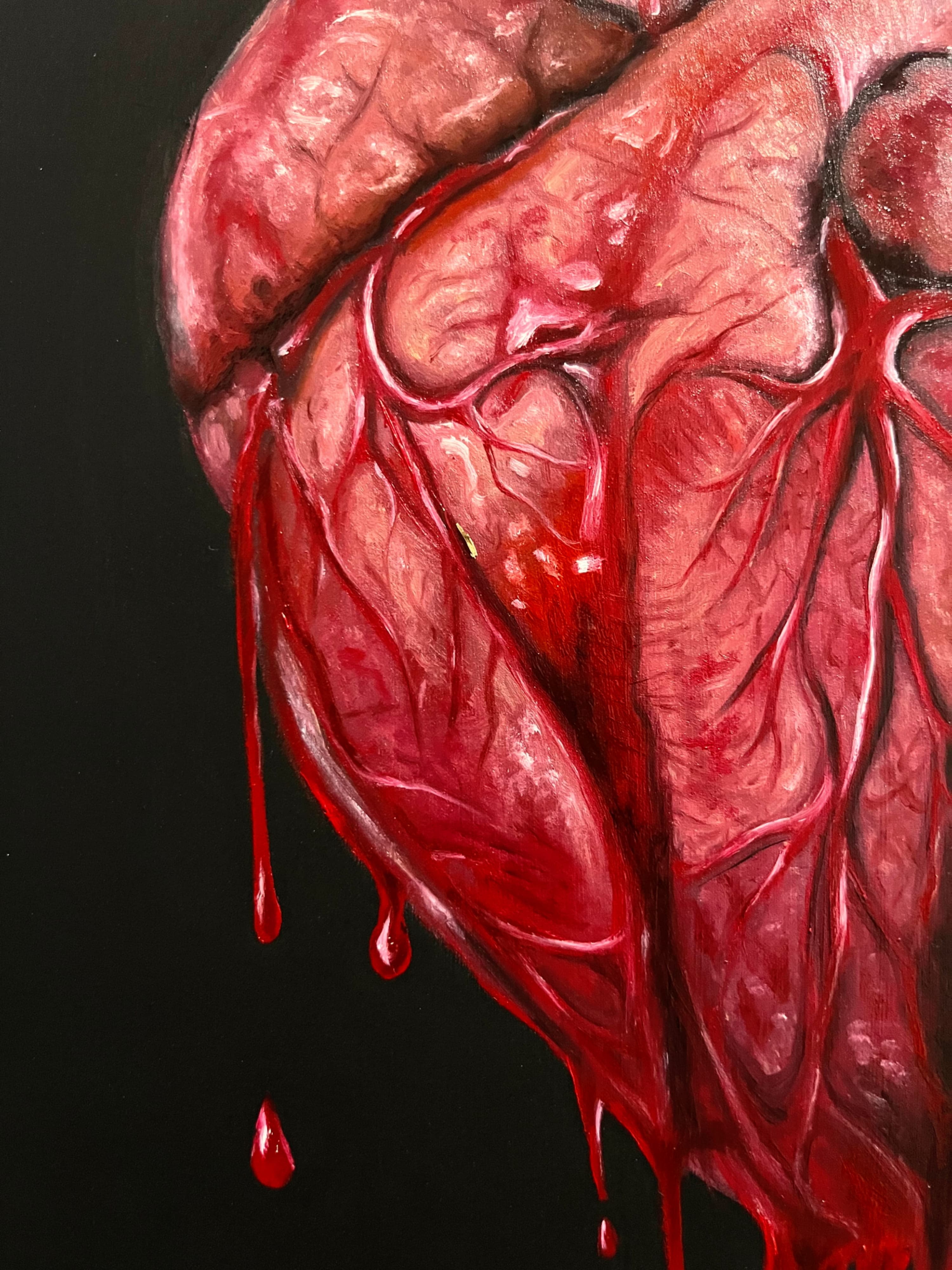 Corazon abierto